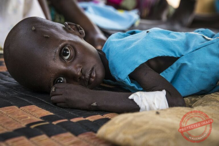 Malnourished child in South Sudann Photo: WFP/Gabriela Vivacqua
